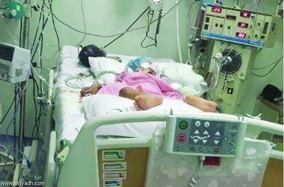 وفاة طفلة بانفلونزا الخنازير في مستشفى رفحاء